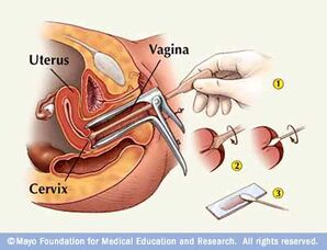 C C Utero7.jpg
