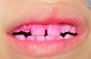 Pastillas reveladoras.jpg