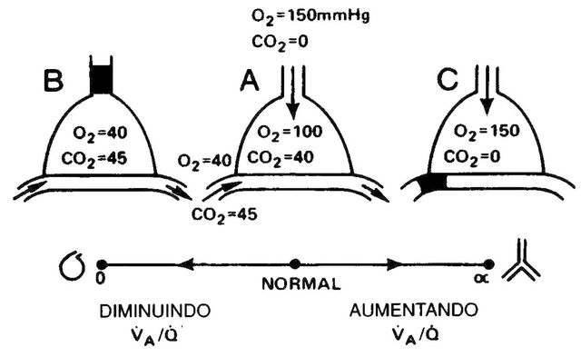 Arquivo:Relaçãoes ventilações e perfusões.jpg