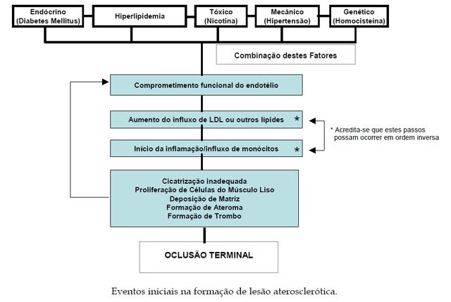Arquivo:INFARTO.jpg