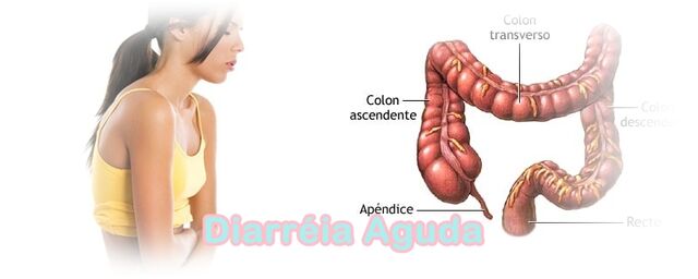 Arquivo:Diarr.jpg