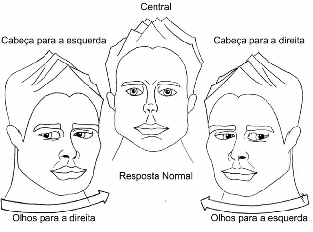 Arquivo:Neuro10.png