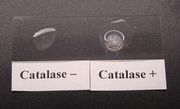 Catalase.gif