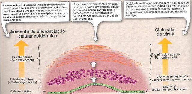 Arquivo:Verruga.jpg