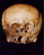 Starchild Skull