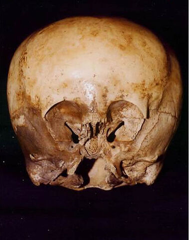 File:Starchild Skull.jpg