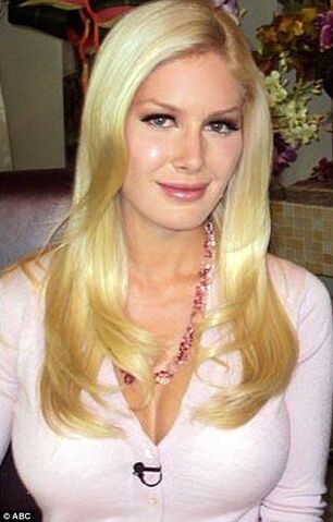 File:Heidi-montag-back-scoop-surgery.jpg