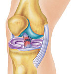 File:Acltear.jpg