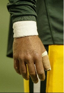 File:Broken Thumb Smaller.jpg