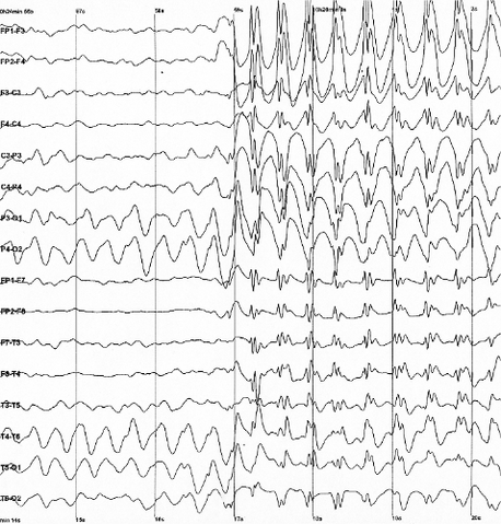 Ficheiro:Spike-waves.png