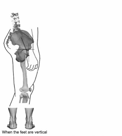 File:Asc Pattern LLD.gif
