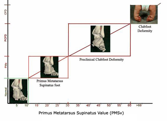 PMVs Values