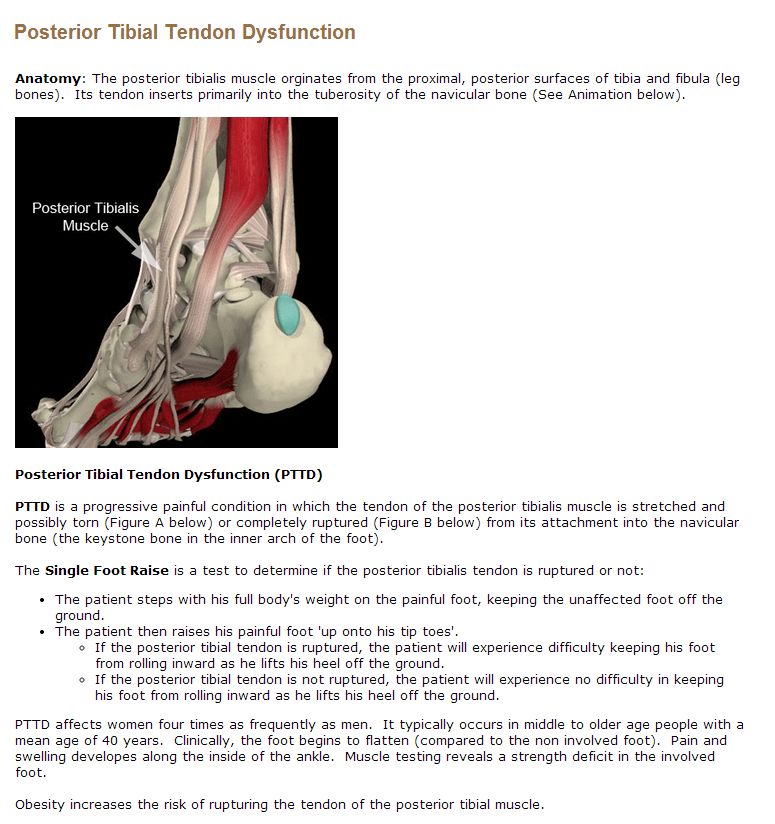 Post Tibial Tendon Dysfunction Intro