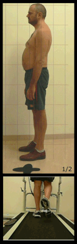 File:PCFD Posture Foot Position.gif