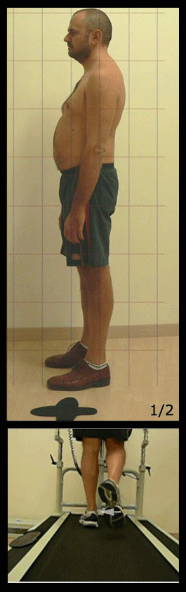 PCFD Posture Foot Position