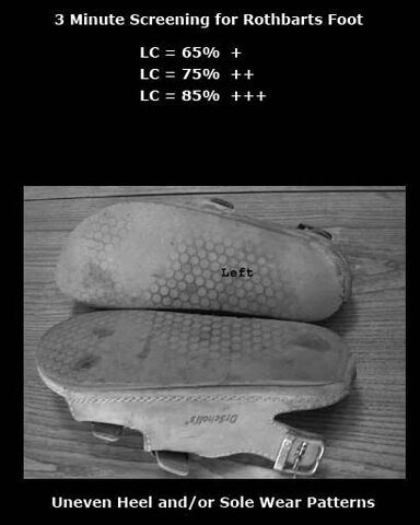 File:Uneven Shoe Wear Patterns.jpg
