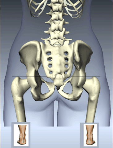 File:Pelvic-Mechanics-vs-FLLD.gif