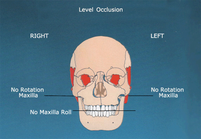 File:Cross Bite.gif
