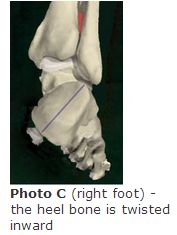 Photo D