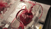Heart transplant boxx519