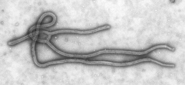 Arquivo:1280px-Ebola Virus TEM PHIL 1832 lores.jpg