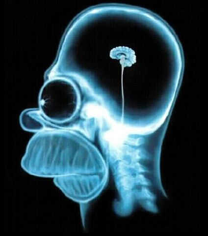 File:HomerBrain.jpg
