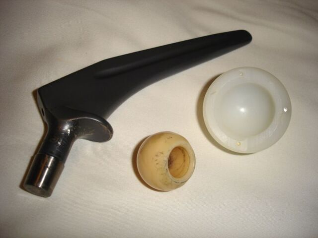 File:Hip prosthesis.jpg