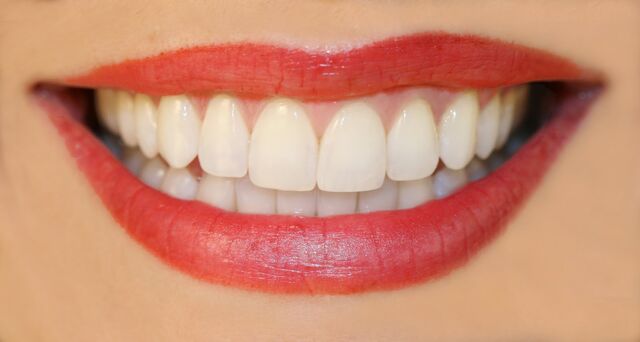 File:A Fabulous Smile.jpg