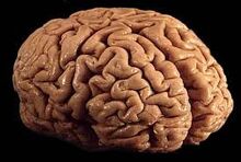 Brain-0