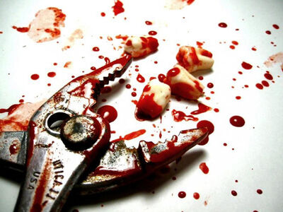 Sacando-Dientes