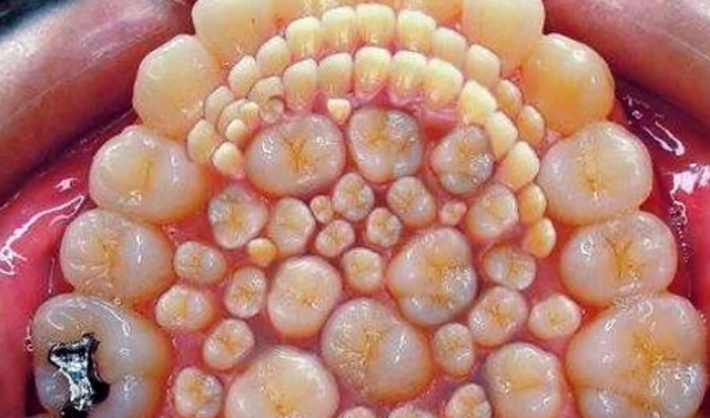 Datei:Trypophobia 3.png