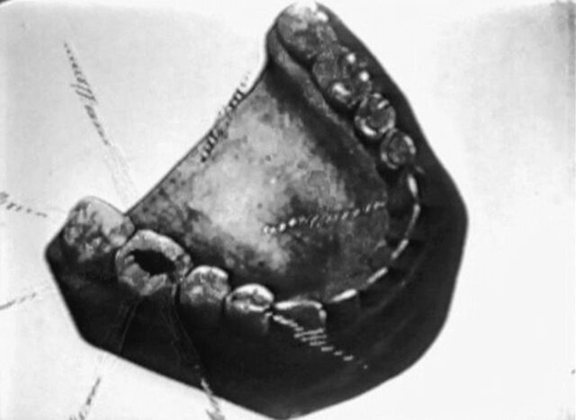File:Tommy tuckers tooth 4.jpg