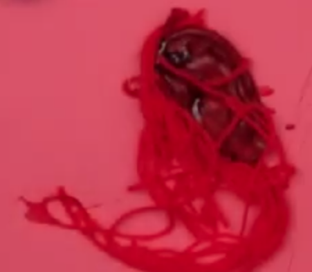 File:Red Puppet's ear.png
