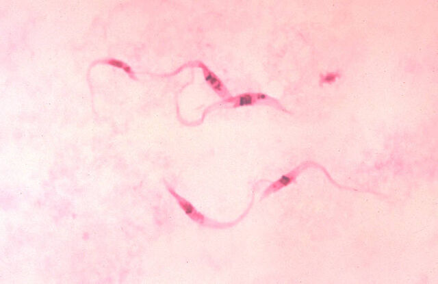 Archivo:Mal de Chagas.jpeg
