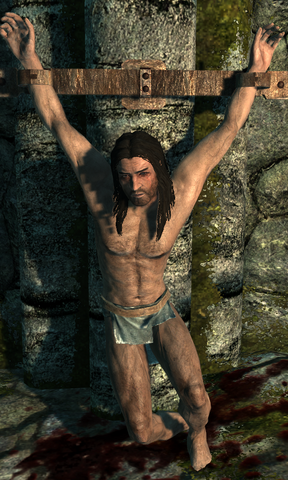 File:Male Torture Victim.png