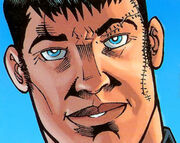 Dallin-scars.jpg