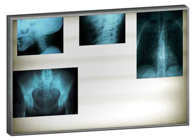 File:X-Ray lightbox.png