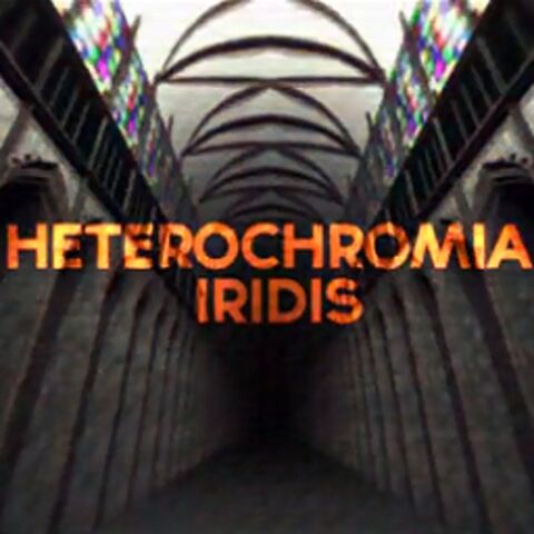 File:Heterochromia Iridis.jpg
