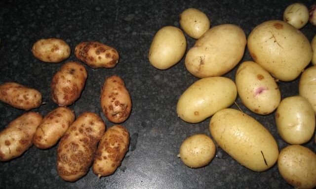 File:Potato Scab.jpg