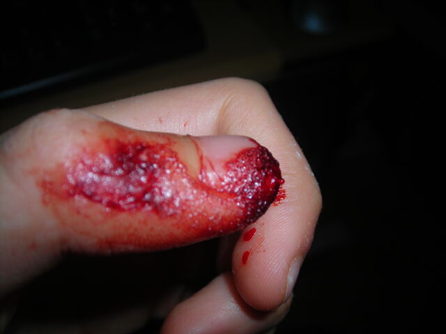 File:Ouch!.jpg