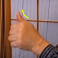 Collapsed-thumb