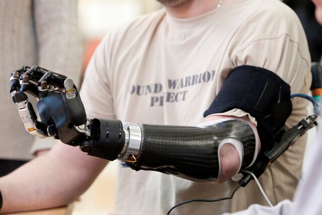 File:Cybernetic arm.jpg