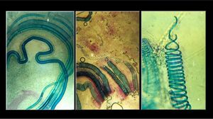 Ficusxylem