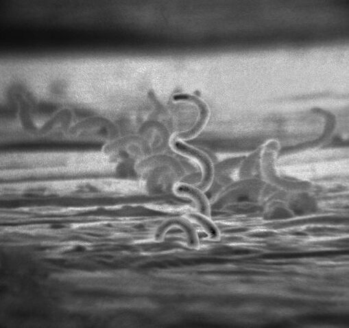 File:Treponema pallidum.jpg