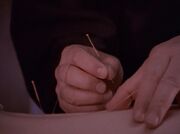 Acupuncture