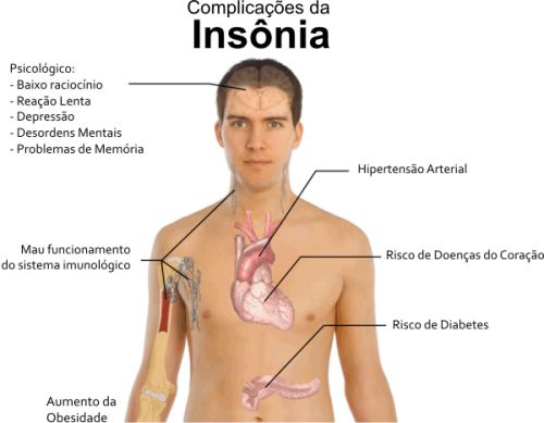 Arquivo:Figura2BrennoV.jpg