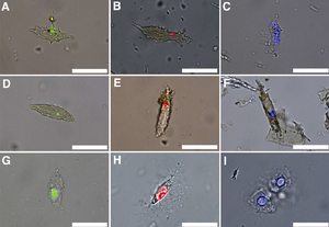 DNA in bones