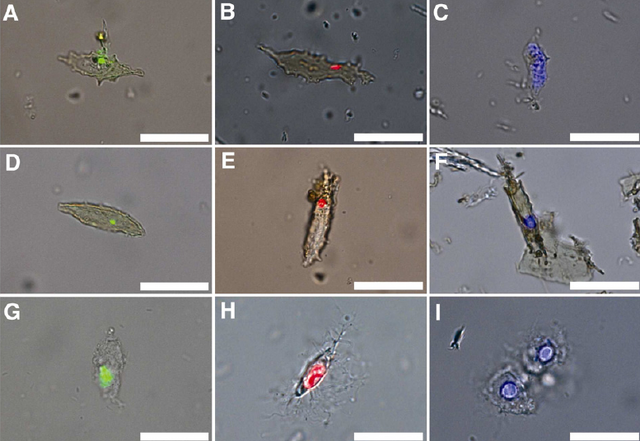 File:DNA in bones.png