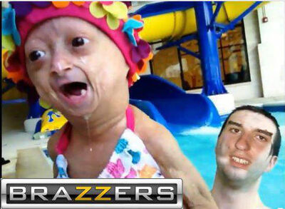 Brazfeenx