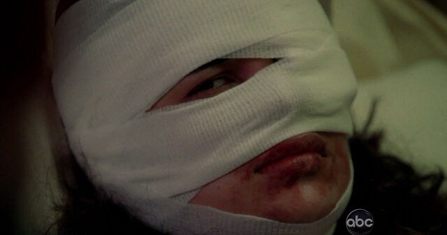 File:5x16 InjuredIlana.jpg